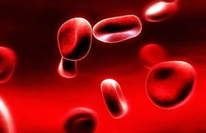 CALTANISSETTA, DOMANI LA GIORNATA MONDIALE DELLA TALASSEMIA talassemia