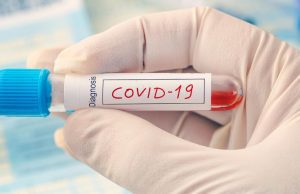 DICIASSETTE I NUOVI CASI POSITIVI E 27 LE GUARIGIONI DA COVID-19 NEL NISSENO Scende sempre più la curva
