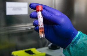 SI REGISTRANO BEN 462 NUOVI PAZIENTI NEL NISSENO, MA ANCHE UN BOOM DI GUARITI Guariti 596 pazienti