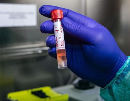 SI REGISTRANO BEN 462 NUOVI PAZIENTI NEL NISSENO, MA ANCHE UN BOOM DI GUARITI Guariti 596 pazienti