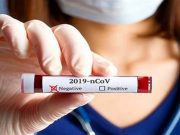 I NUOVI PAZIENTI POSITIVI SONO 284 IN PROVINCIA DI CALTANISSETTA sono 209 i nuovi casi positivi