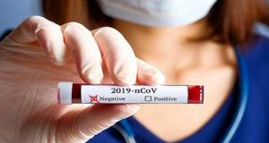 SONO 209 I NUOVI CASI POSITIVI ODIERNI IN PROVINCIA DI CALTANISSETTA sono 209 i nuovi casi positivi