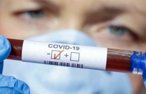 GUARITI 176 PAZIENTI IN PROVINCIA DI CALTANISSETTA: 127 I NUOVI CASI POSITIVI i pazienti positivi sono 121