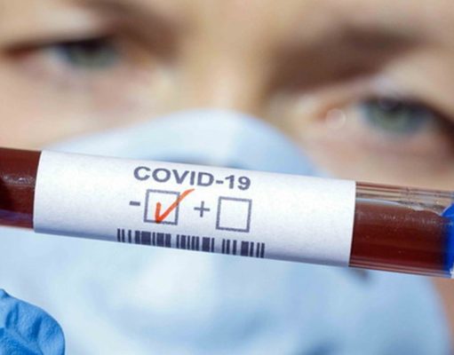 I PAZIENTI POSITIVI SONO 121, I GUARITI DAL COVID-19 NEL NISSENO SONO INVECE 81 i pazienti positivi sono 121
