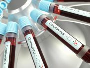 BALZO IN AVANTI DEL CONTAGIO: 646 NUOVI CASI POSITIVI E UN DECESSO A SANTA CATERINA VILLARMOSA Sono 314 i guariti