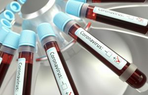 BALZO IN AVANTI DEL CONTAGIO: 646 NUOVI CASI POSITIVI E UN DECESSO A SANTA CATERINA VILLARMOSA Sono 314 i guariti